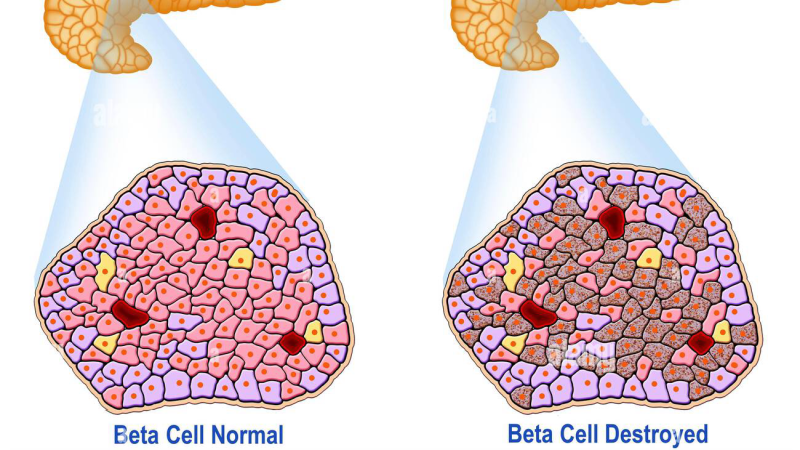 pancreatic beta cell electron micrograph