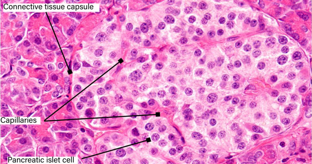 Glucotrust Bites: How Beta Cell Exhaustion Drives Persistent Blood Sugar Spikes