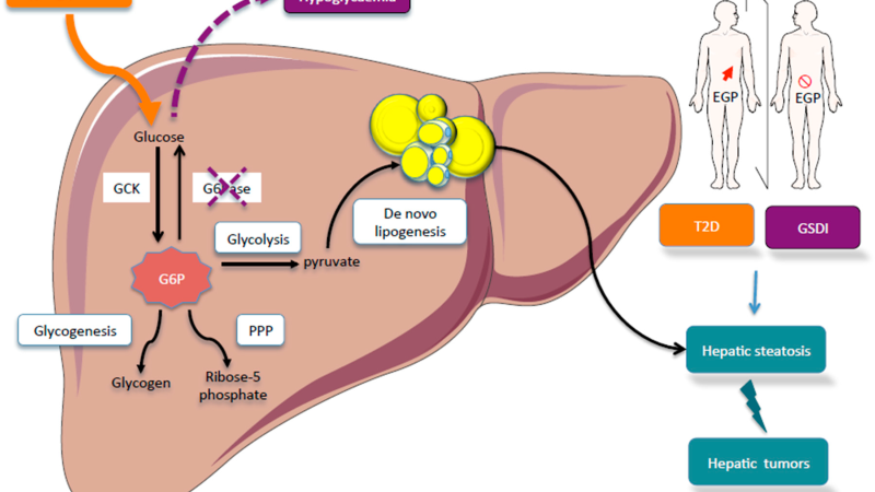 hepatic gluconeogenesis pathway illustration