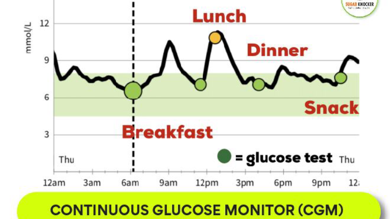blood glucose variability graph showing spikes after meals and continuous glucose monitoring data