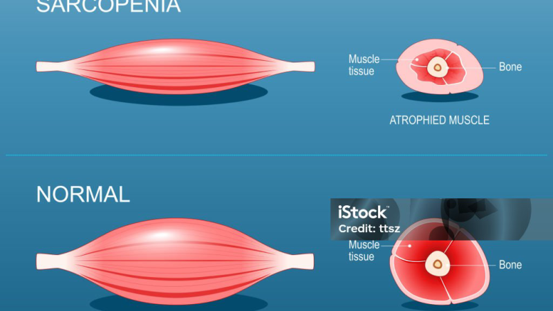 sarcopenia muscle fiber comparison illustration