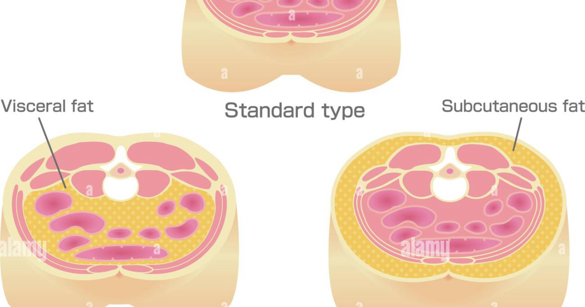 Insufend: The Real Culprit – How Visceral Fat Becomes an Endocrine Organ Driving Insulin Resistance