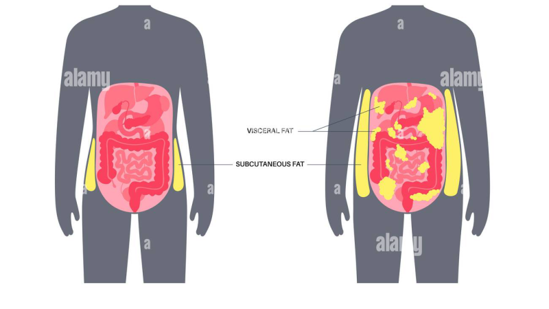 visceral fat around organs illustration