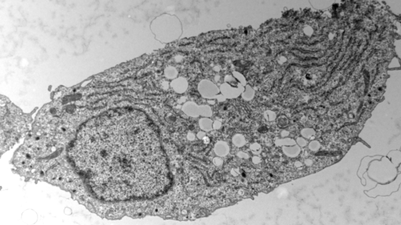 pancreatic beta cell mitochondria electron microscopy