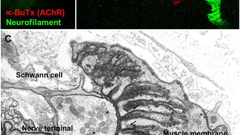 synapse under electron microscope healthy versus degenerating