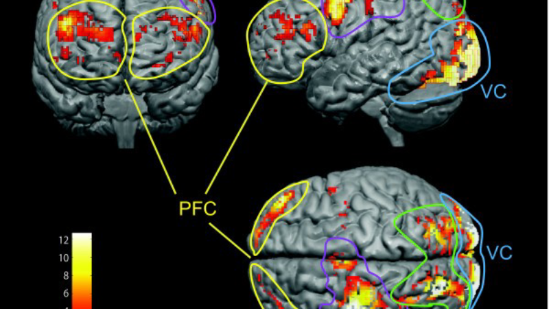 fMRI brain scan showing prefrontal cortex activation