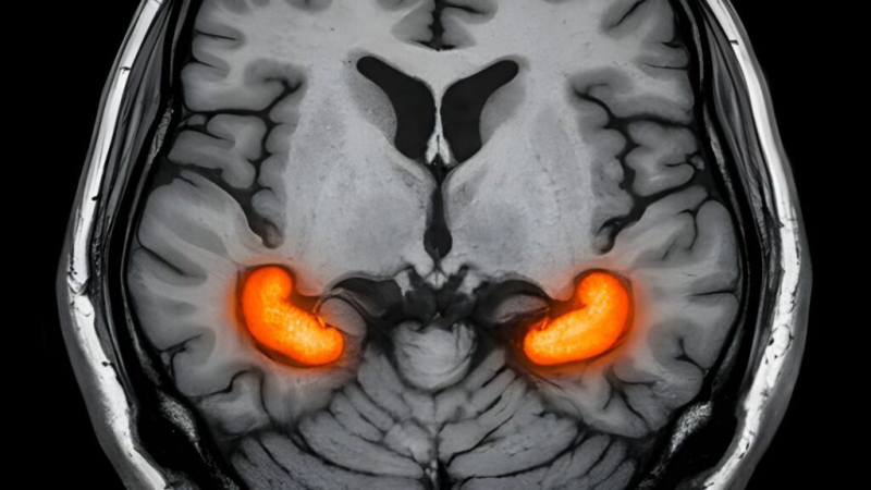 HIIT and brain health illustration