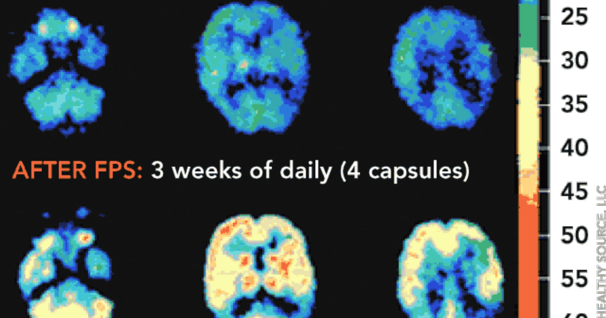 Quantum Brainwave Protocol: Reversing Insulin Resistance in the Brain to Prevent Cognitive Decline