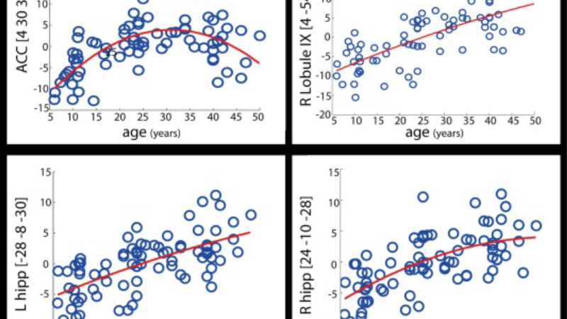 brain scan glucose metabolism aging