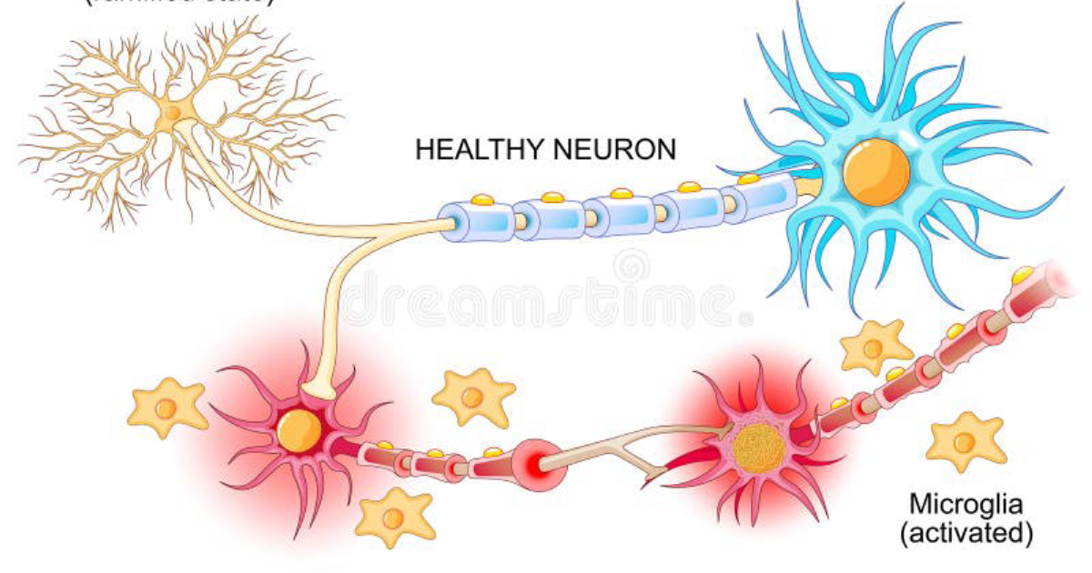 The Genius Wave: Beyond Brain Fog – Unraveling the Role of Neuroinflammation in Synaptic Dysfunction