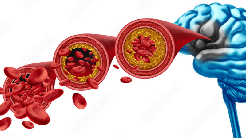 aging brain blood flow decline illustration