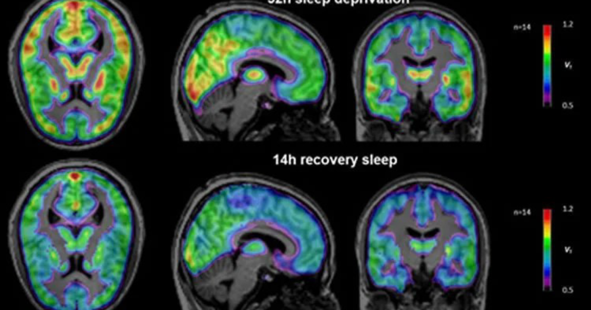 Vital Hemp: How Endocannabinoid Tone Regulates Your Sleep Cycle and Fights Insomnia