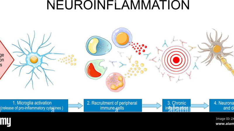 brain microglia inflammation illustration