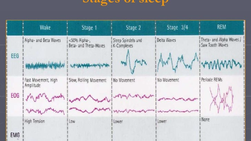 polysomnography graph showing increased slow-wave sleep with hemp supplementation