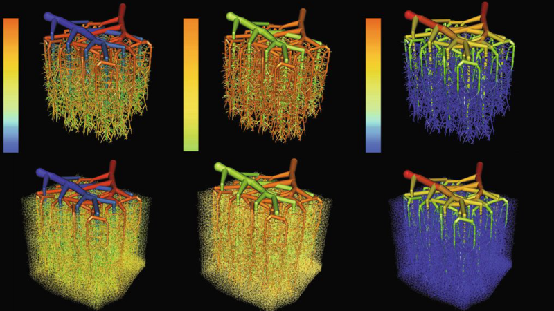 cerebral microvessels blood flow brain MRI scan