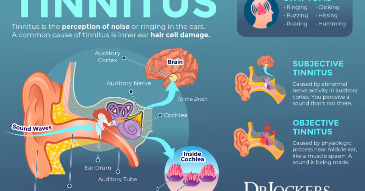Neuro Quiet: Die Verbindung zwischen Ohrschlag und Hörverlust – wie das Gehirn betroffen ist