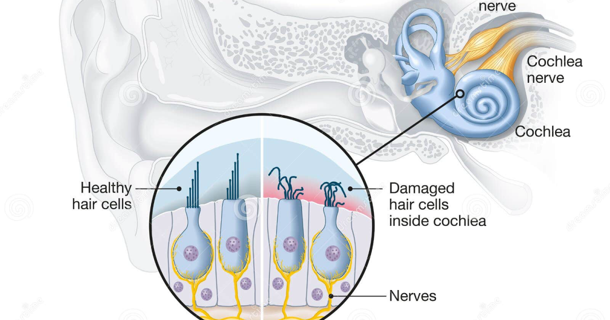 Neuro Quiet: Glutamat-Exzitotoxizität in der Cochlea – Die biochemischen Auslöser lärmbedingter Hörschäden