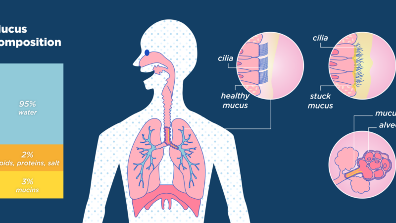chest x-ray showing mucus plugging