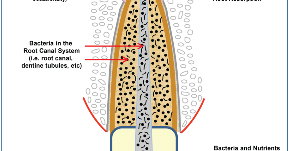 DentaBiome: How Enterococcus faecalis Survives Root Canals and Threatens Systemic Health