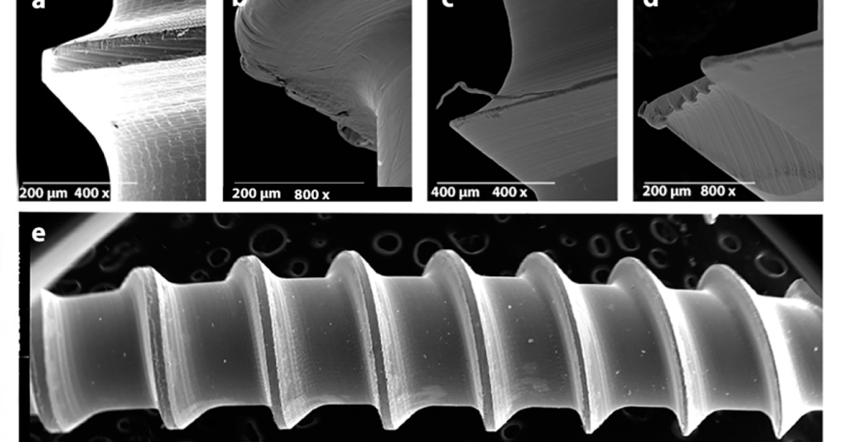 DentaBiome: How Titanium Surface Topography Drives Dental Implant Osseointegration