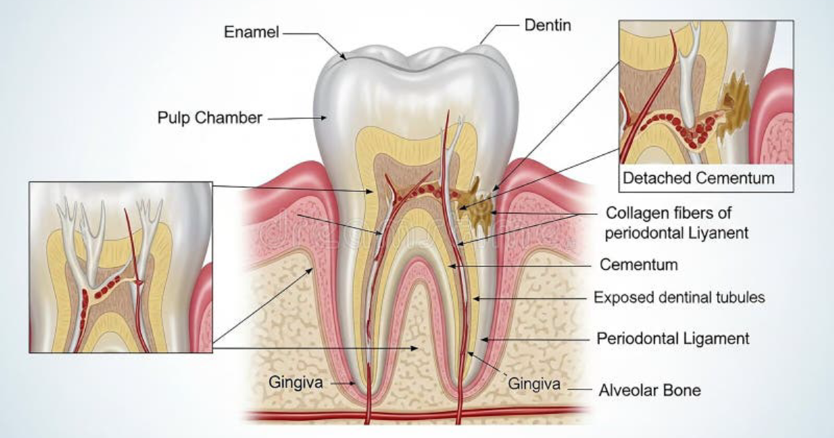 DentaBiome: The Biomechanics of Occlusal Trauma and Tooth Mobility