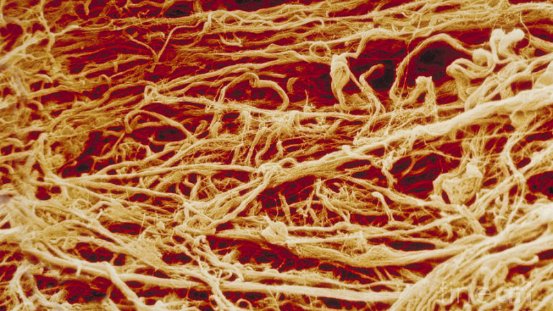 periodontal ligament microscopic anatomy illustration