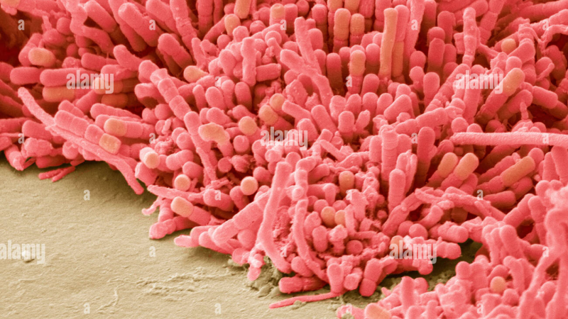 dental plaque biofilm under microscope showing bacteria and acid production