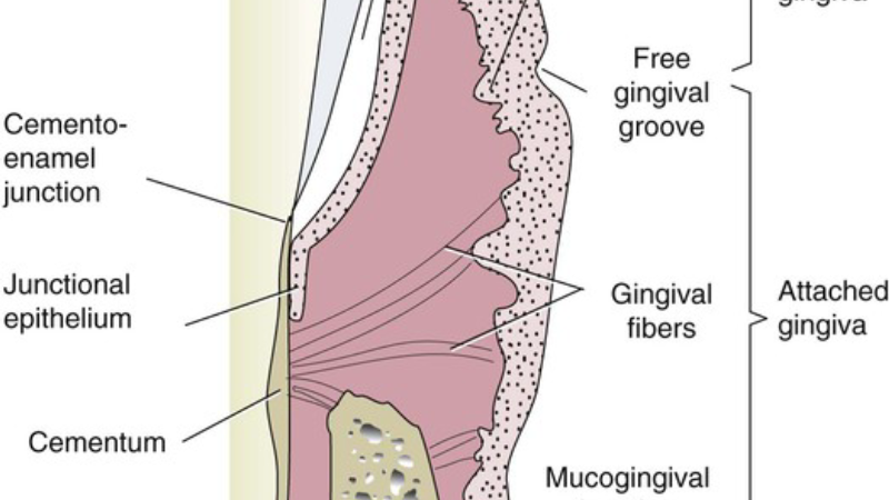 cross-section of gum tissue showing gingival sulcus and inflammatory cells