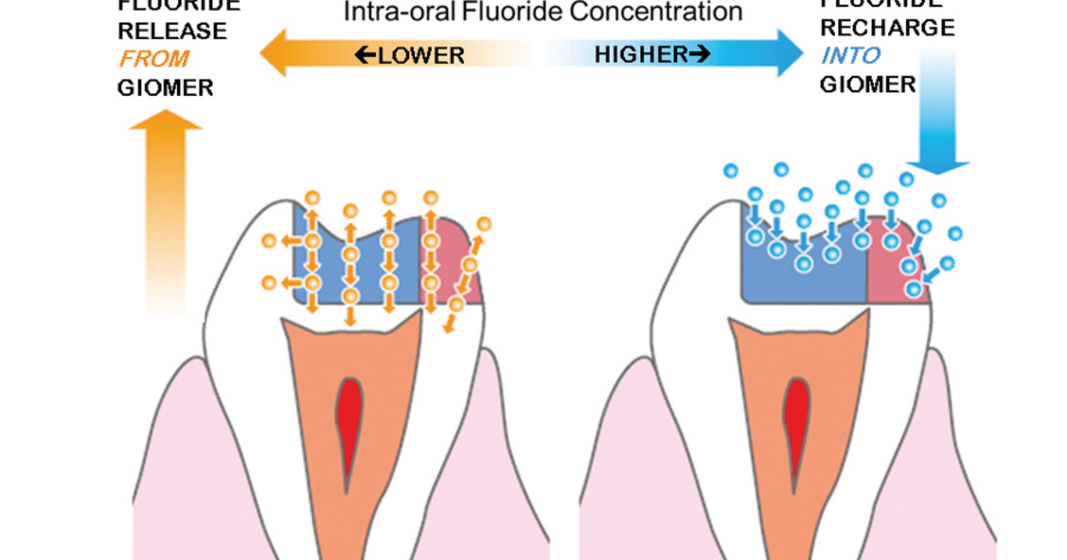 DentaBiome: The Science Behind Fluoride's Role in Cavity Prevention and Enamel Health