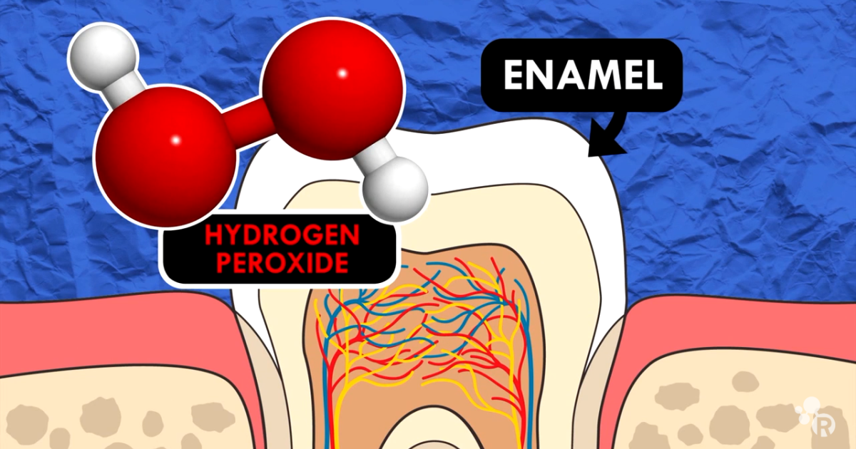 DentaBiome: The Science of Tooth Whitening — Hydrogen Peroxide Penetration and Enamel Safety