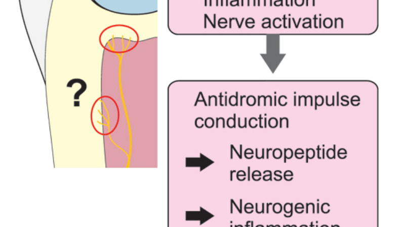inflammatory mediators cascade diagram