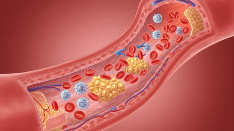 gums inflammation bleeding periodontal pocket illustration