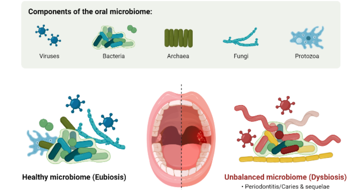 Oradentum: How Lactobacillus reuteri Rebalances Oral Microbiota to Prevent Gingivitis