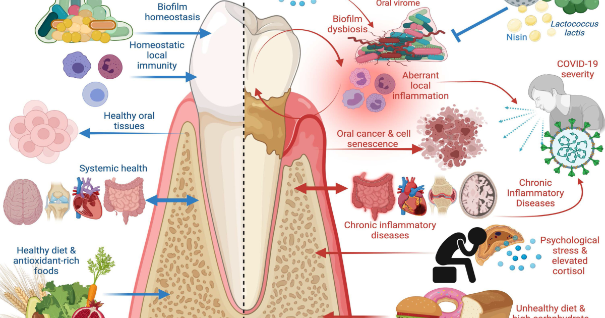Oradentum: How Periodontal Disease Fuels Cardiovascular Inflammation and What to Do About It