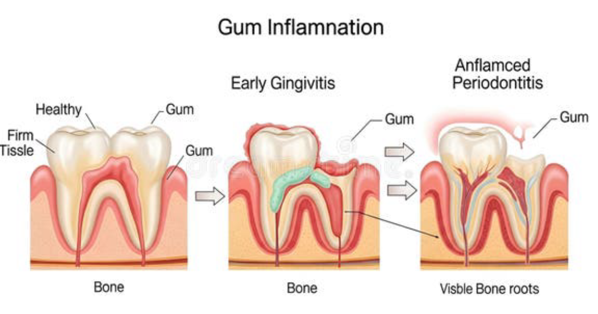 Oradentum: Restoring Oral Microbiome Balance Through Natural Pathways