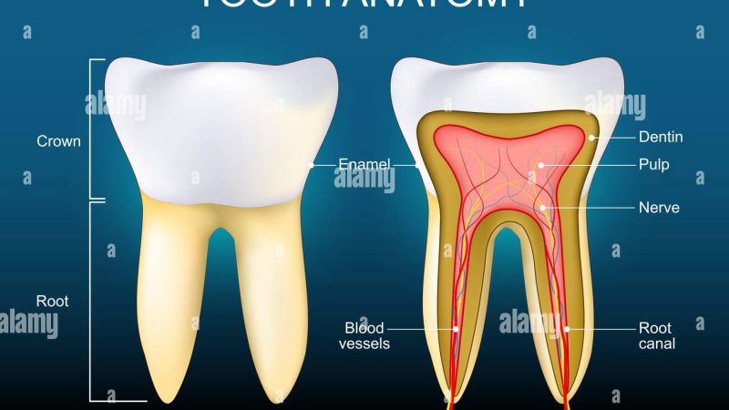 close-up of teeth with tetracycline staining before and after bleaching and supplement support