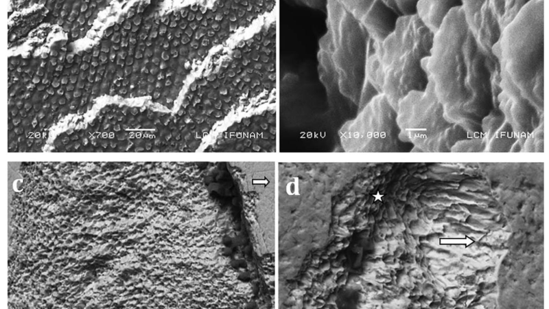 enamel erosion SEM image magnification