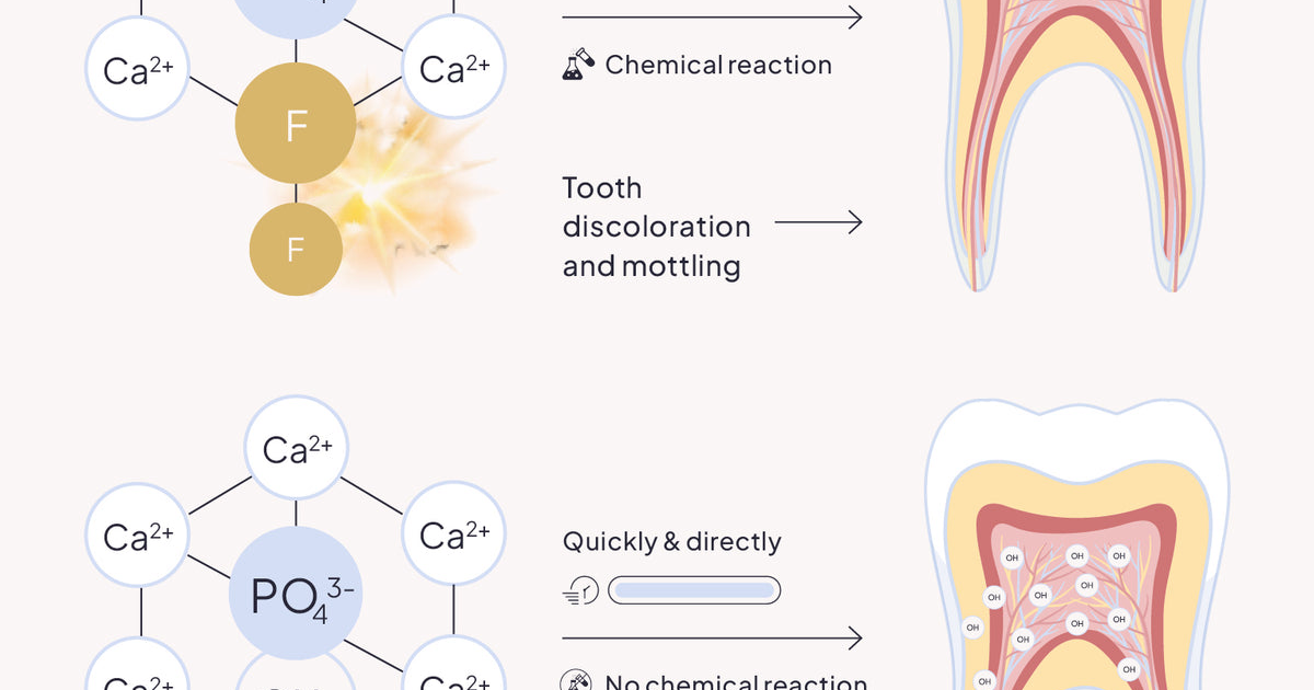 Oradentum: Why Fluoride Remains the Gold Standard for Caries Prevention