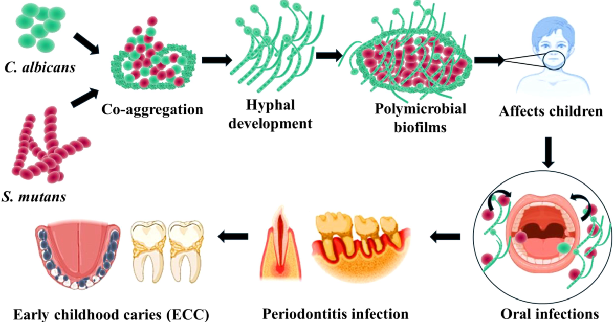 Oradentum: Xylitol vs. Sorbitol – A Clinical Comparison of Effects on Streptococcus mutans Adhesion and Acid Production