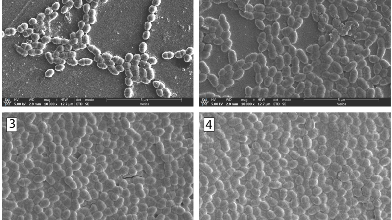 streptococcus mutans biofilm formation microscopic view
