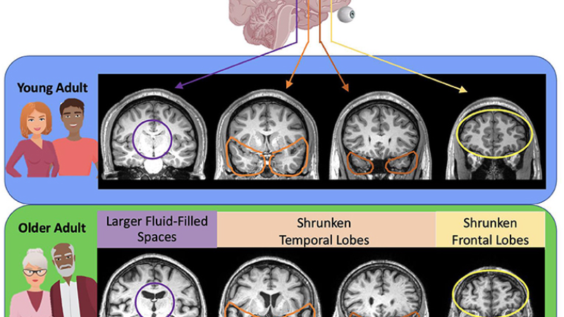 brain hippocampus neural network synapse illustration