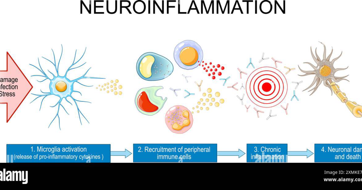 The Genius Wave: Cómo la Neuroinflamación Causa Niebla Mental y Cómo Reducir la Activación Microglial