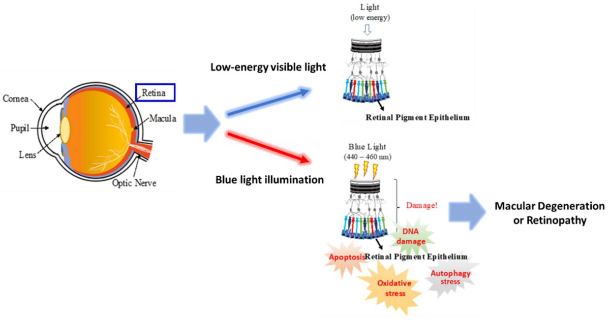 Visivra: El Impacto de la Luz Azul en las Células del Epitelio Pigmentario de la Retina y Cómo Protegerlas