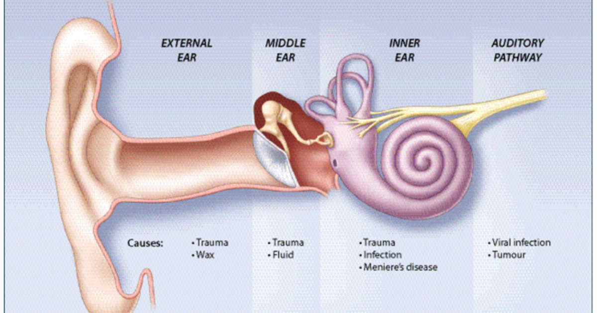 Tinnitus 911: La Verdad Sobre el 'Ataque' Auditivo – ¿Qué Sucede Cuando la Audición se Desvanece Repentinamente?