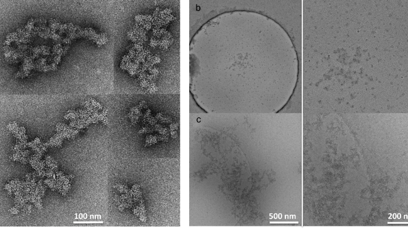 lens protein aggregation diagram under microscope