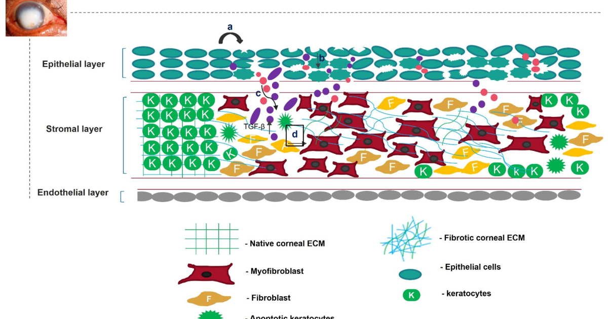 Visivra: Unlocking the Molecular Secrets of Corneal Wound Healing