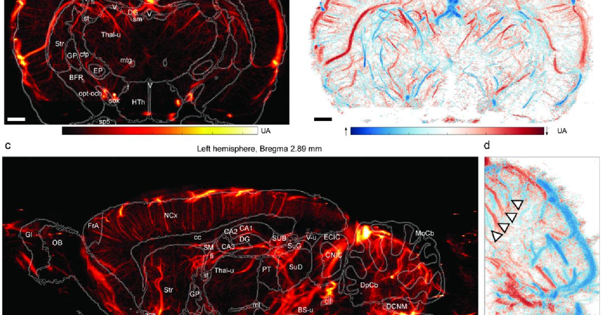 Harmobrain : Comment le déclin du flux sanguin cérébral affecte votre mémoire