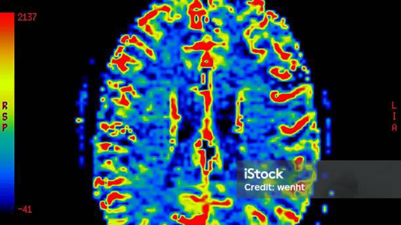 illustration microvaisseaux cerveau
