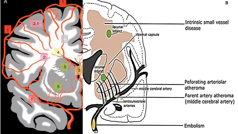 microscopie des capillaires cérébraux perfusion sanguine