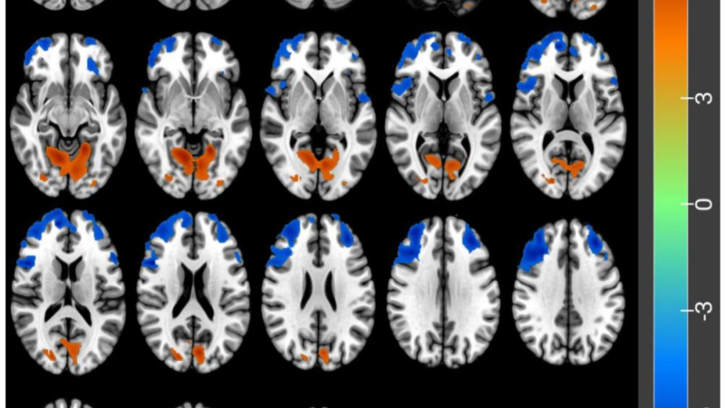 cross-section of sleeping brain glymphatic flow